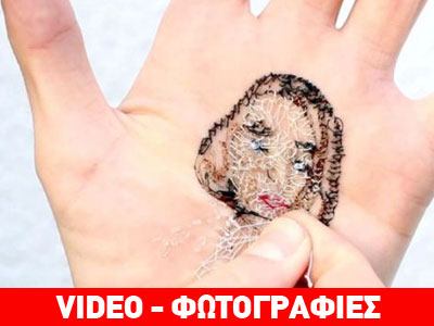 Κάνει «τατουάζ» χρησιμοποιώντας ράμματα