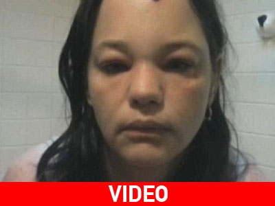 Γυναίκα δέχτηκε απίστευτη επίθεση από τη γάτα της