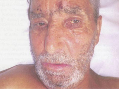 Λάρισα: Στα αζήτητα νεκρός εδώ και ενάμιση χρόνο