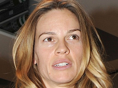 Μήπως χρειάζεσαι botoxάκι;