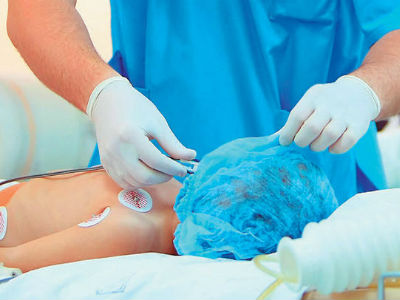 Ρόδος: Κοριτσάκι 22 μηνών κατάπιε καυστική σόδα