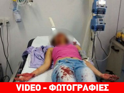 Απίστευτο: Επέζησε με μαχαίρι καρφωμένο στο κεφάλι