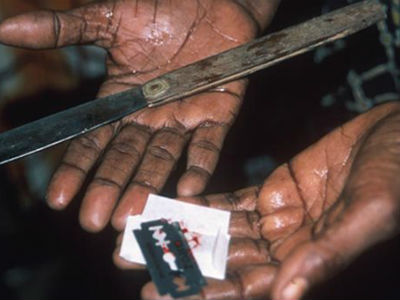 Καταδικάστηκε γιατρός που ακρωτηρίασε τα γεννητικά όργανα 13χρονης