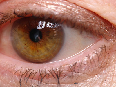 Αναπτύχθηκαν κύτταρα αμφιβληστροειδούς…από το δέρμα