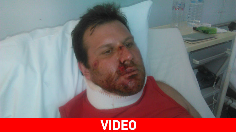 Λέσβος: Σκύλος έστειλε δικυκλιστή στο νοσοκομείο