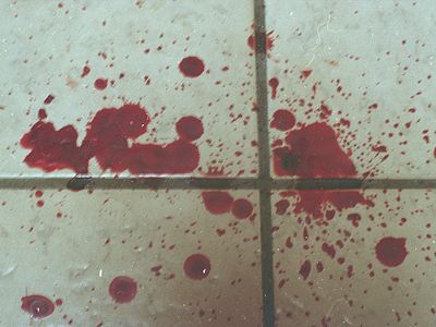 Αυτοκτόνησε με κυνηγετική καραμπίνα