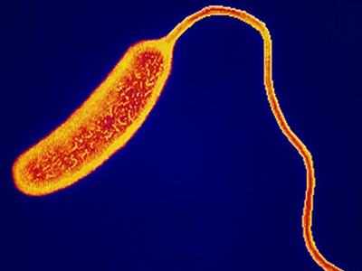 H χολέρα πέρασε στις ΗΠΑ