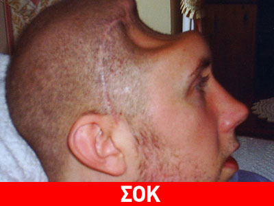 Του αφαίρεσαν το μισό κούτελο!