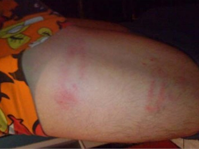 Καταγγελία 17χρονου για αστυνομική βία