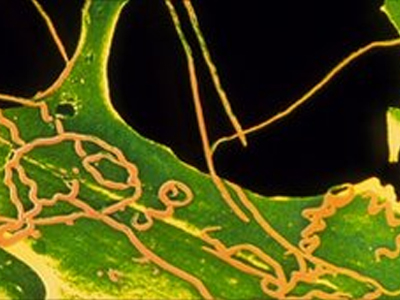 Η συγνώμη άργησε 64 χρόνια