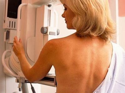 Δωρεάν μαστογραφία σε ανασφάλιστες γυναίκες