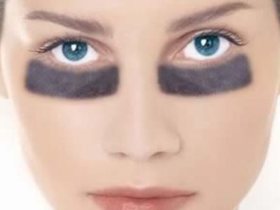 Εξαφανίστε τους μαύρους κύκλους