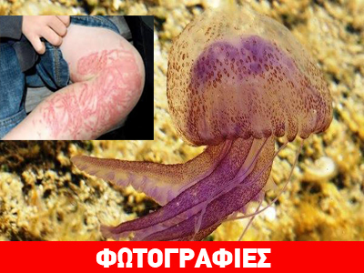 Όλα όσα πρέπει να ξέρετε για τις τσούχτρες στις ελληνικές θάλασσες