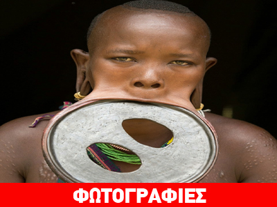 Η γυναίκα που το στόμα της ξεπερνάει το μισό μέτρο