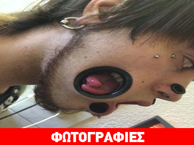Φρίκη: Έκανε extreme piercing ώστε να έχει στόμα και στο μάγουλο