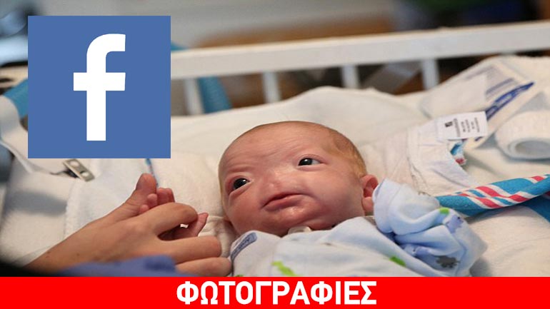 Το μωρό που γεννήθηκε χωρίς μύτη και η περιπέτεια στο Facebook