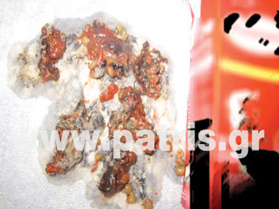 Βρήκε πολτοποιημένο τρωκτικό σε συσκευασία σάλτσας