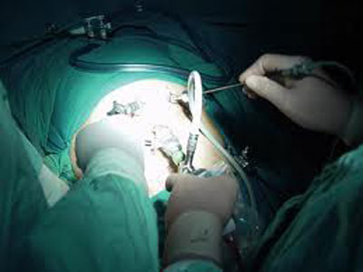 Σεμινάριο λαπαροσκοπικής  χειρουργικής στα Ιωάννινα