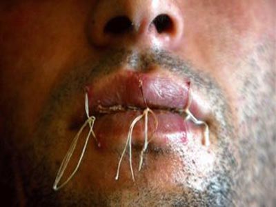 Κιργιστάν: Συνολικά 1.319 κρατούμενοι έχουν ράψει τα χείλη τους