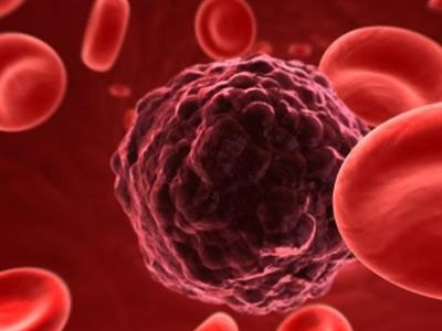 Ανακαλύφθηκε ο φυσικός «διακόπτης» που λέει stop στις μεταστάσεις