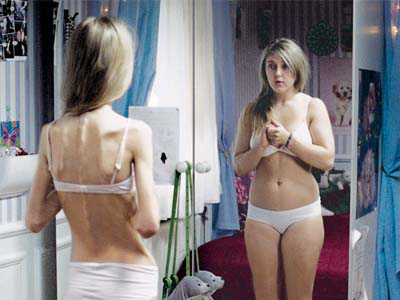 Σε δίαιτα και πλαστικές επεμβάσεις μία στις δύο έφηβες