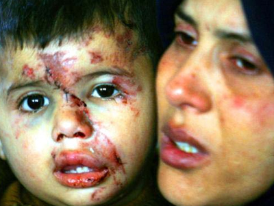 Σε εγρήγορση το Ισραήλ για την έκθεση «Goldstone»