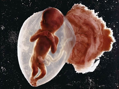 Ένα «θαύμα» 36 εβδομάδων