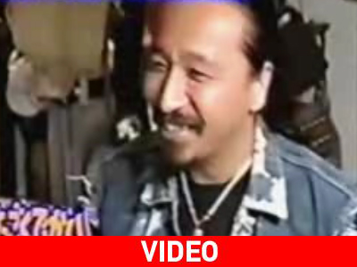 Ο άνθρωπος με τα πιο περίεργα δάχτυλα