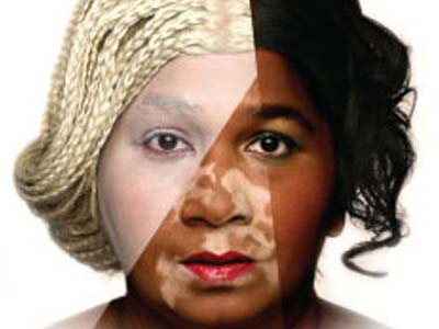 Εκστρατεία υπέρ της φυσικής ομορφιάς