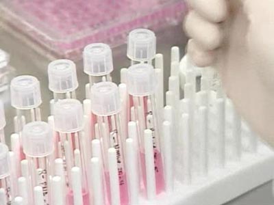 Ο ιός Η1Ν1 εξαπλώθηκε σε τουλάχιστον 160 χώρες