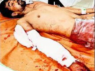 Μεθυσμένος τραυματίστηκε σοβαρά από τίγρη