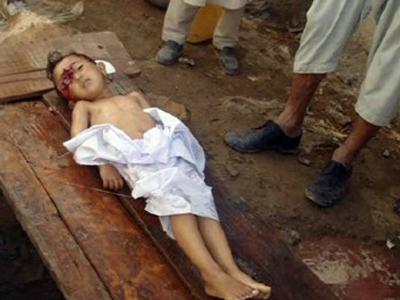 Αίμα παιδιών από επιδρομή του ΝΑΤΟ