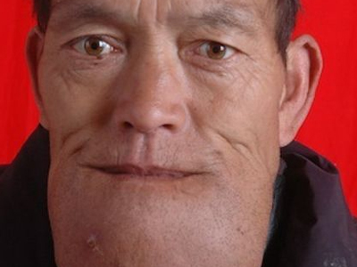 Διαφημιστείτε στο… σαγόνι του