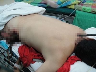 Και όμως γλίτωσε