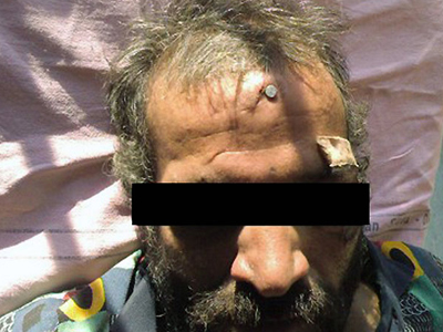 Παιχνίδια με το θάνατο σε φυλακές της Ρουμανίας