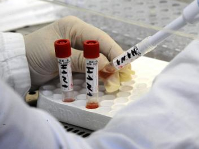 Τουρκία: Ένας νεκρός τη μέρα από τη νέα γρίπη