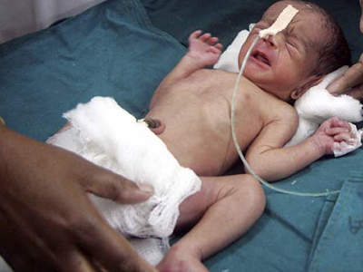 Νεογέννητο έπεσε από τρένο και επέζησε