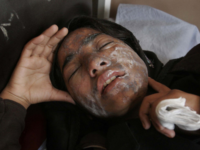 Επίθεση με οξύ σε αγορά του Χονγκ Κονγκ