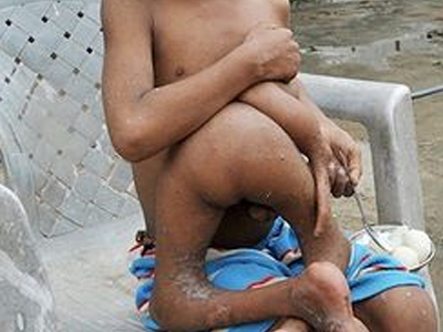 Το παιδί με τα επτά άκρα