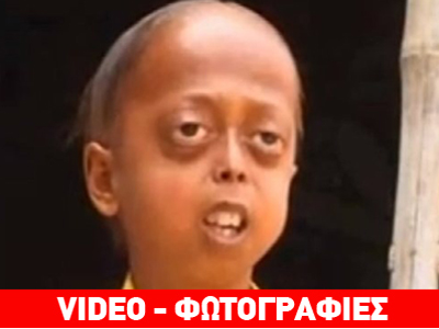 Σπάνια νόσος εγκλωβίζει έφηβο σε σώμα υπεραιωνόβιου