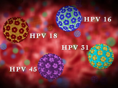 Επιστημονικά αποδεδειγμένη πλέον η σύνδεση καρκίνου της μήτρας και καρκίνου του φάρυγγα