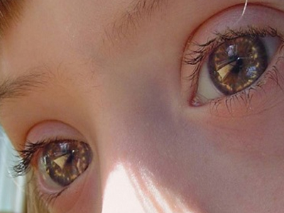 Παγκόσμια Ημέρα για το Σύνδρομο Down Παγκόσμια Ημέρα για το Σύνδρομο Down