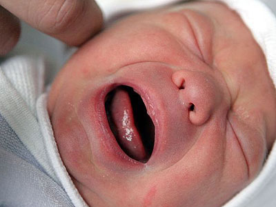 Όλα όσα πρέπει να ξέρετε για τα πρόωρα