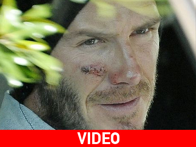 Ο David Beckham υποβλήθηκε σε χειρουργική επέμβαση