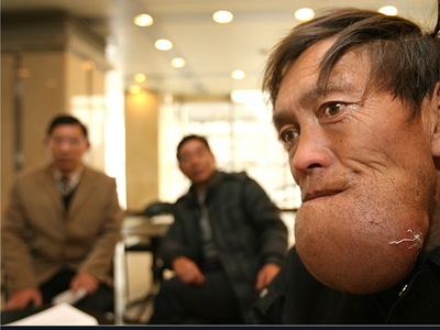 Ένα τραύμα του άλλαξε τη ζωή