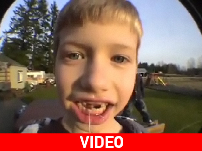 Πώς να «εκτοξεύσετε» το δόντι σας