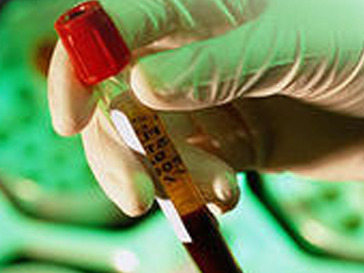 Παγκόσμια Ημέρα Νεφρού