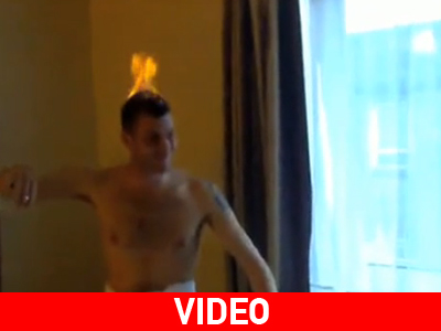 Πυρπόλησε το κεφάλι του…