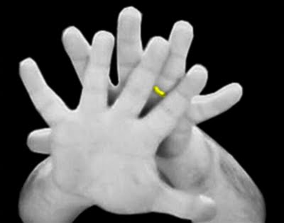 Ο κλασσικός ο μ…. ο έλληνας!