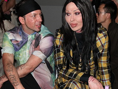 Μήπως το παράκανε;